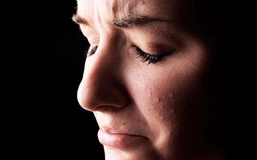 Acne conseguenze psicologiche e possibili rimedi