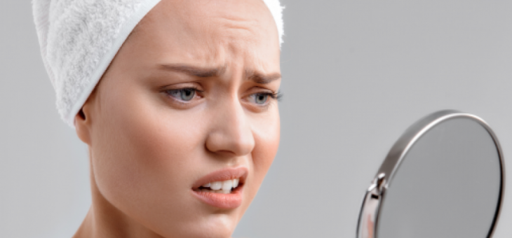 Acne: conseguenze psicologiche e possibili rimedi